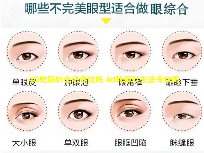 4D轮廓针去法令纹吗 4d轮廓针去法令纹吗